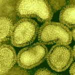 Víirus Gripe A (H1N1)